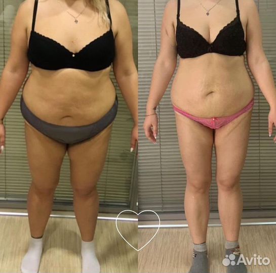 Вакуумно роликовый массаж,похудение