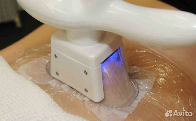 Криолиполиз,кавитация,карбоновый пилинг,эндо360