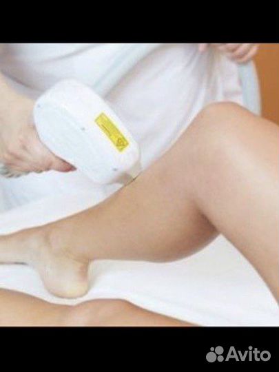 Лазерная эпиляция