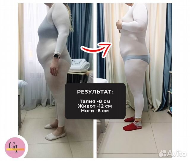 Аппаратный массаж