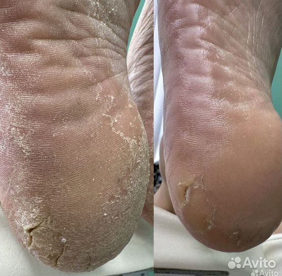 Курсы по корректирующим системам