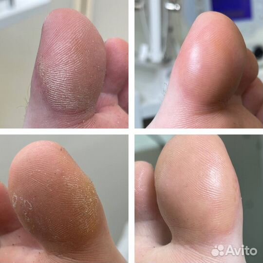 Курсы педикюра обучение с нуля, повышение