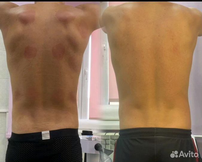 Коррекции фигуры (аппаратная и много др)