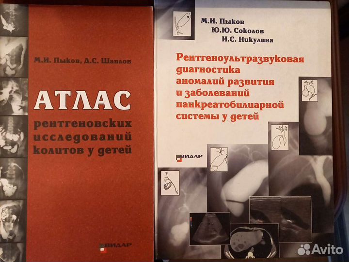 Томография рентген узи