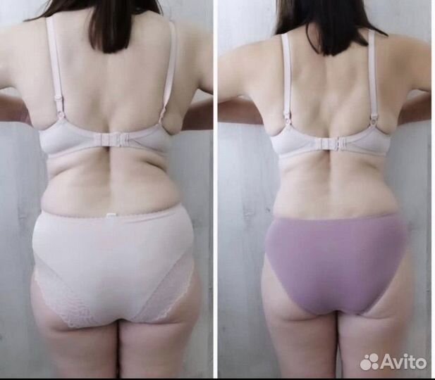 LPG массаж в Новороссийске