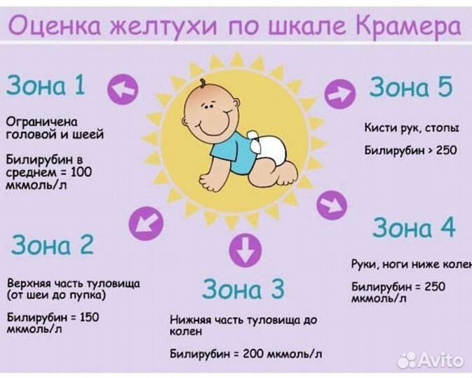 Лампа от желтушки