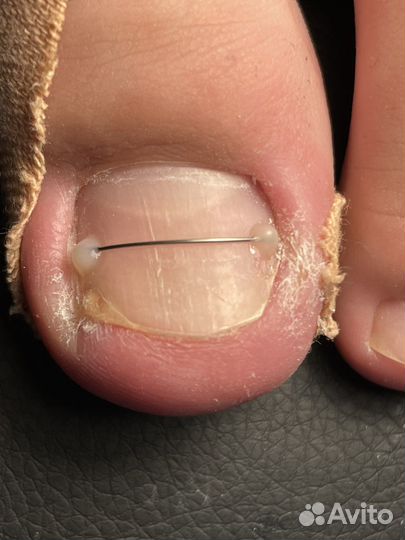 Маникюр, педикюр, подолог