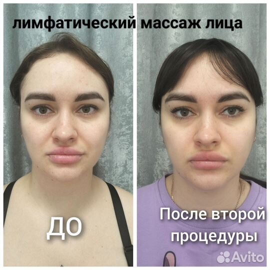 Модель на лимфомассаж лица