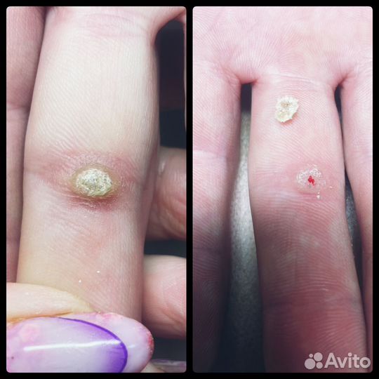 Подолог с выездом на дом для пожилых