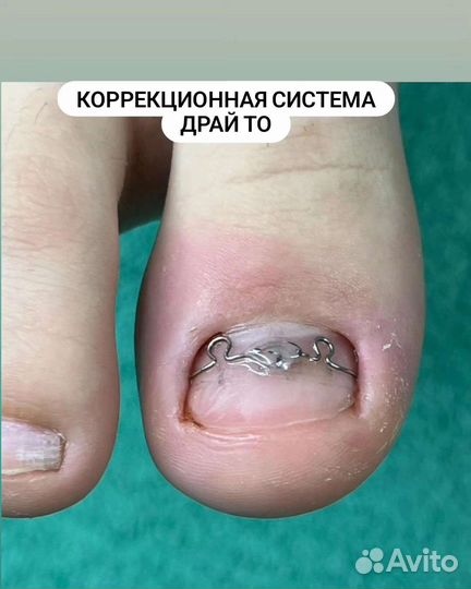 Подолог/Педикюр/Выезд возможен