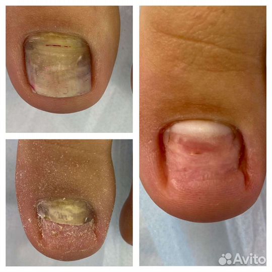 Педикюр модели