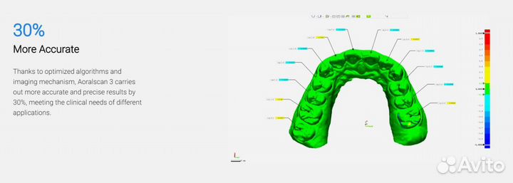 Сканер интраоральный Shining3d Aoralscan 3