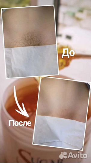 Шугаринг на дому