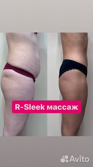 R-sleek, авторский курс массажа