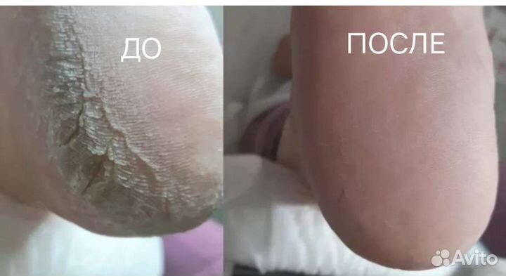 Маникюр/Педикюр