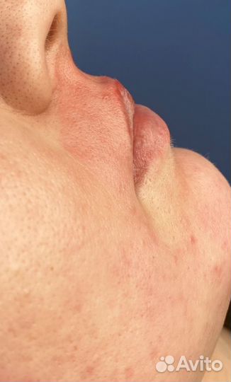 Депиляция (Сахар и воск)