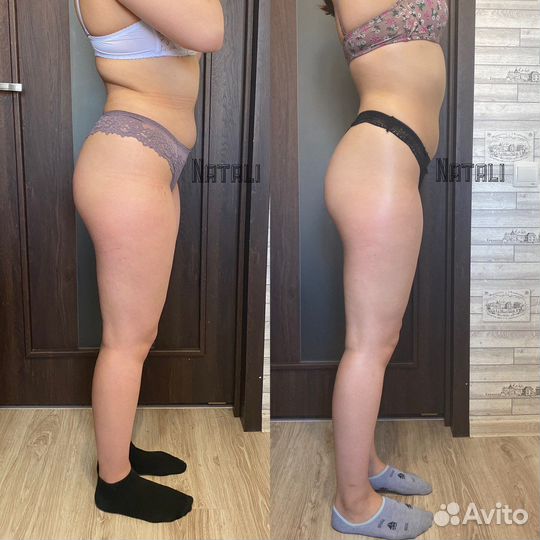 Антицеллюлитный Массаж: ручной и аппаратный