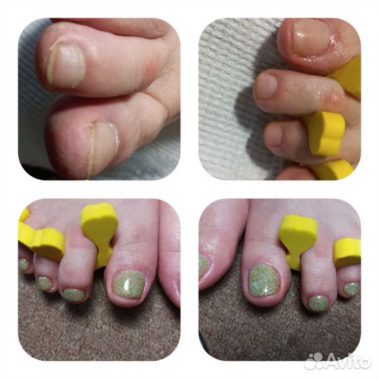 Аппаратный маникюр