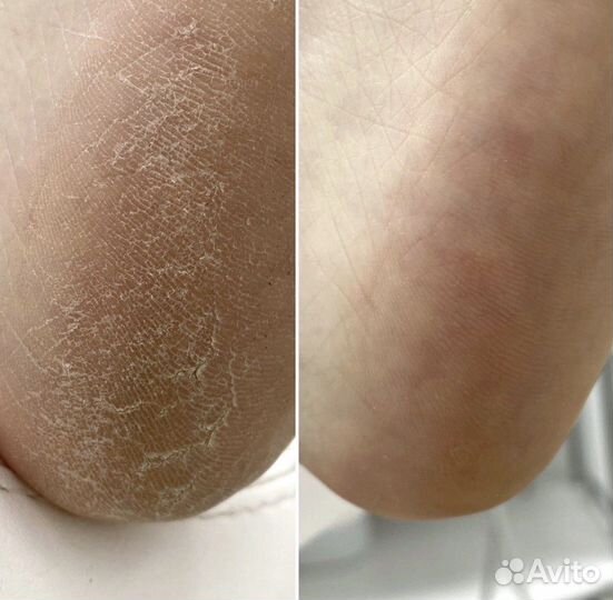 Подолог. Здоровье стоп и ногтей