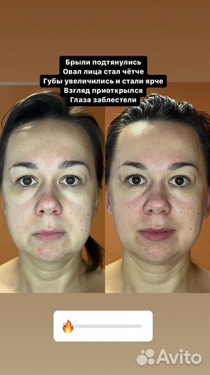 Массаж лица