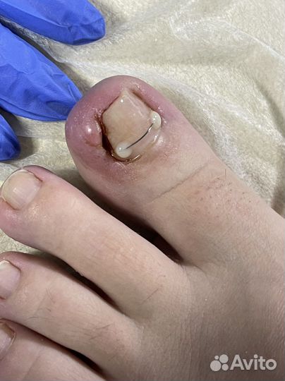 Выезд на дом, подолог