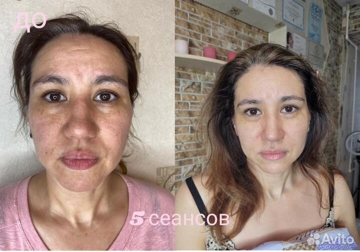 Массаж лица и тела