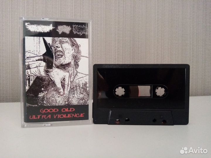 Sacrococcygeal Teratoma / Bodily Wastes / Candidal