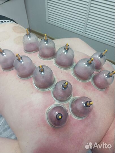 Массажист, Миопрессура, Мануальщик, Костоправ