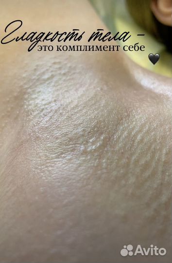Депиляция воском