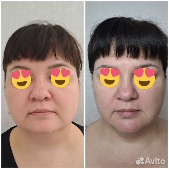 Массаж, мадеротерапия