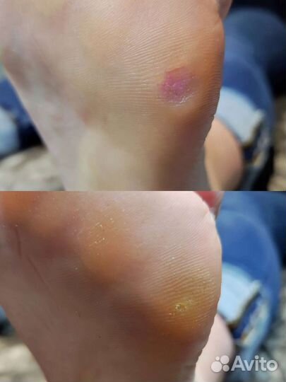 Мастер педикюра-подолог-консультация