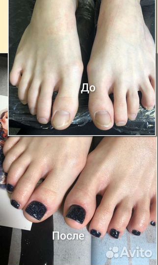 Smart педикюр