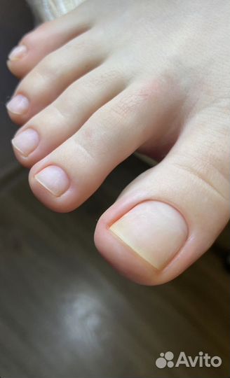 Педикюр, подолог