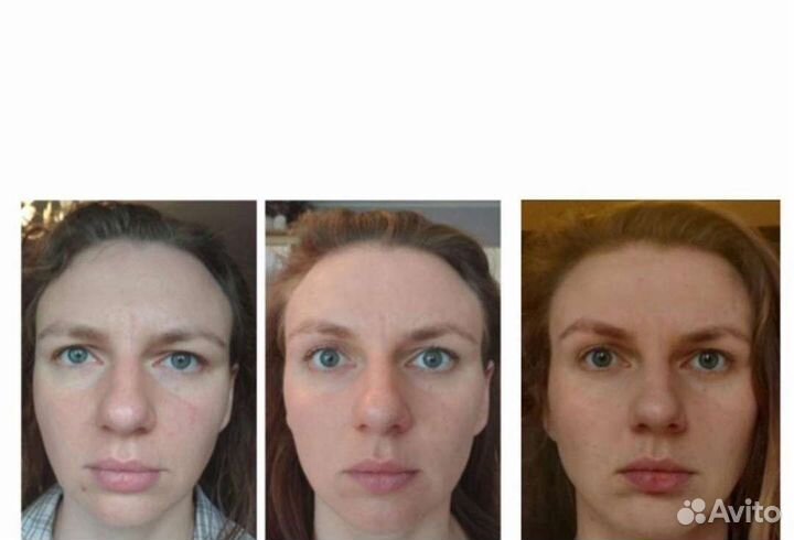 Фейсфитнес/Массаж лица/Фейслифтинг/Тренер/Пилатес