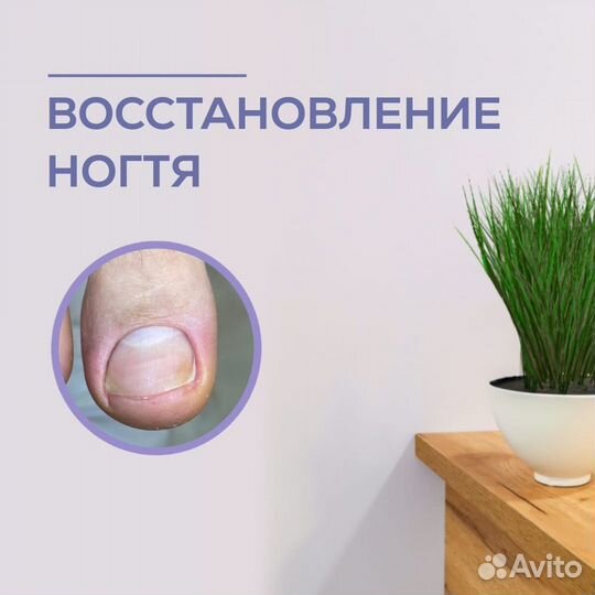 Подолог. Вросший ноготь. Мозоли. Грибок. Ортез