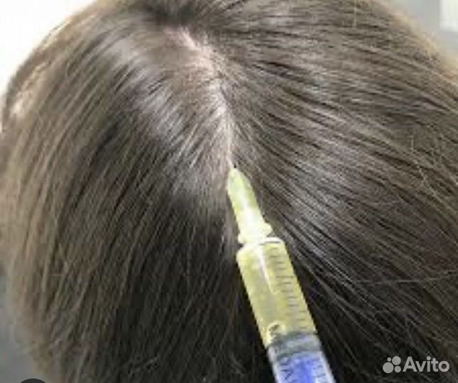 Плазмолифтинг