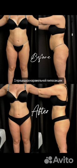 Массаж, коррекция фигры, СПА