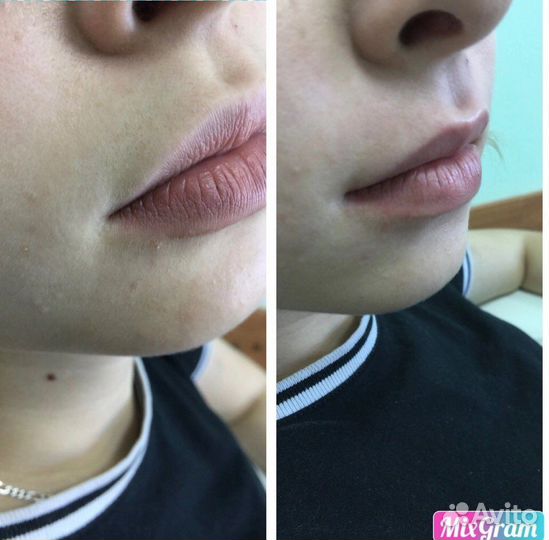 Мастер по шугарингу