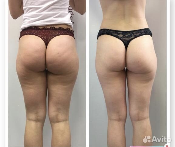 Массаж центральный район