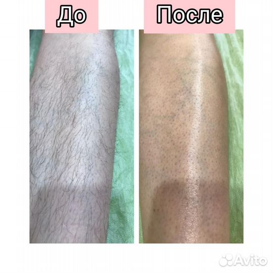 Восковая депиляция