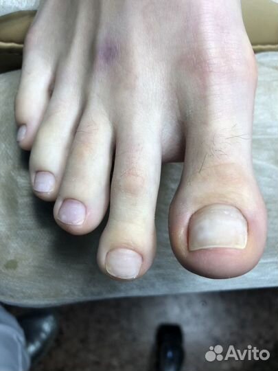 Индивидуальное обучение. аппаратный педикюр