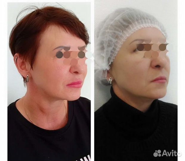 Услуги косметолога