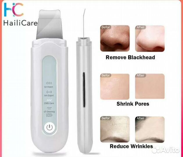 Прибор для ультразвуковой чистки лица