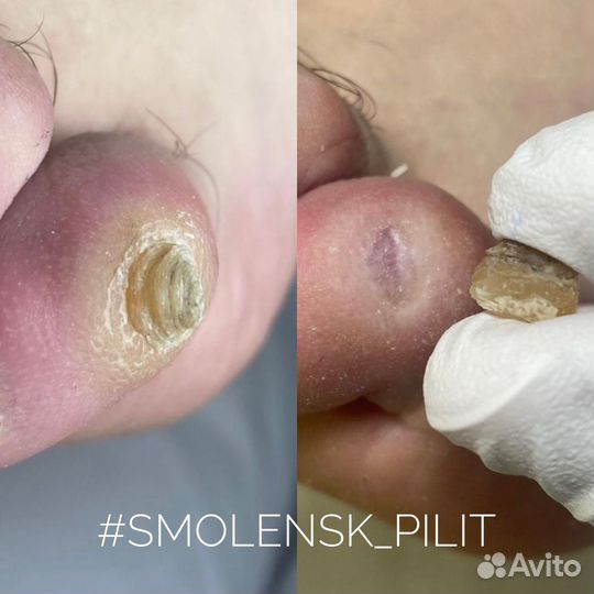 Услуги подолога