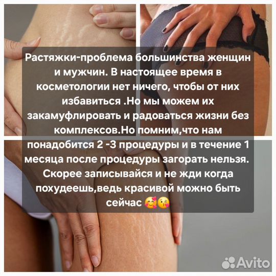 Камуфляж рубцов и шрамов,растяжек и ареол