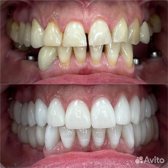 Врач стоматолог хирург имплантолог