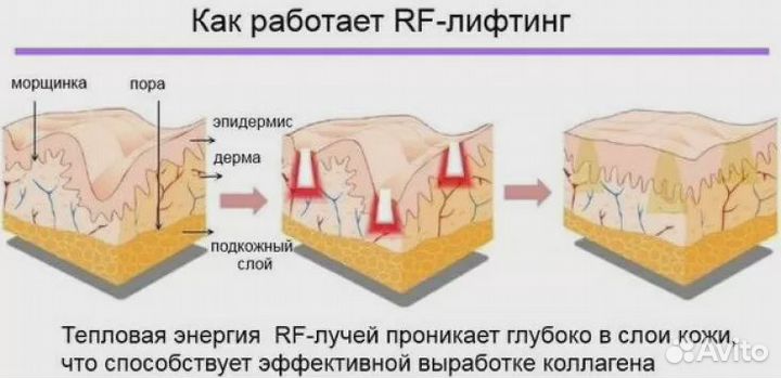 Аппаратная коррекция фигуры