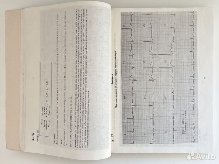 Экг Циммерман. Книги по кардиологии