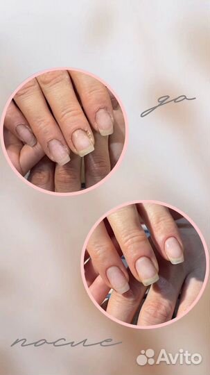 Маникюр на дому