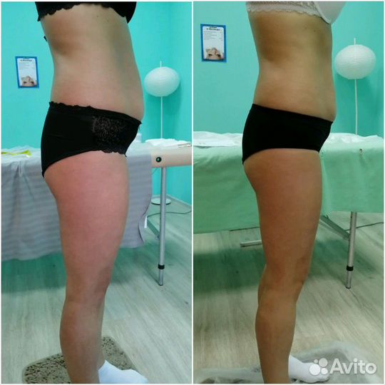 Коррекция фигуры, Ручная пластика лица, Уход